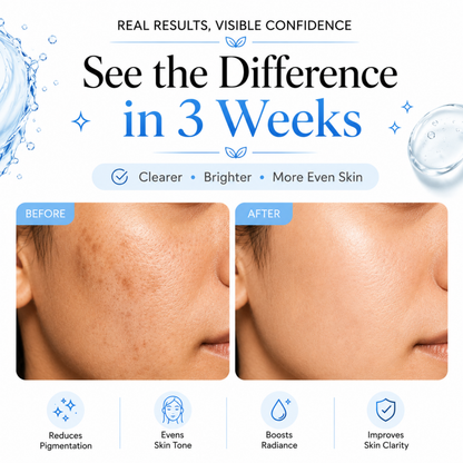 Hydra Boost Face Serum (30ml)