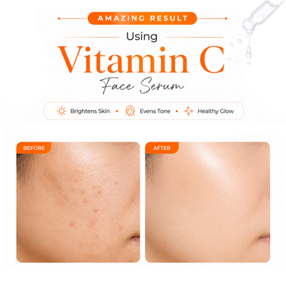 Vitamin C Face Serum (30ml)