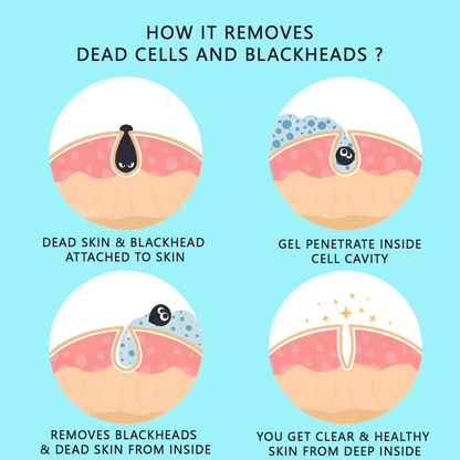 Aloevera Tanning & Dead Skin Remover (100ml)